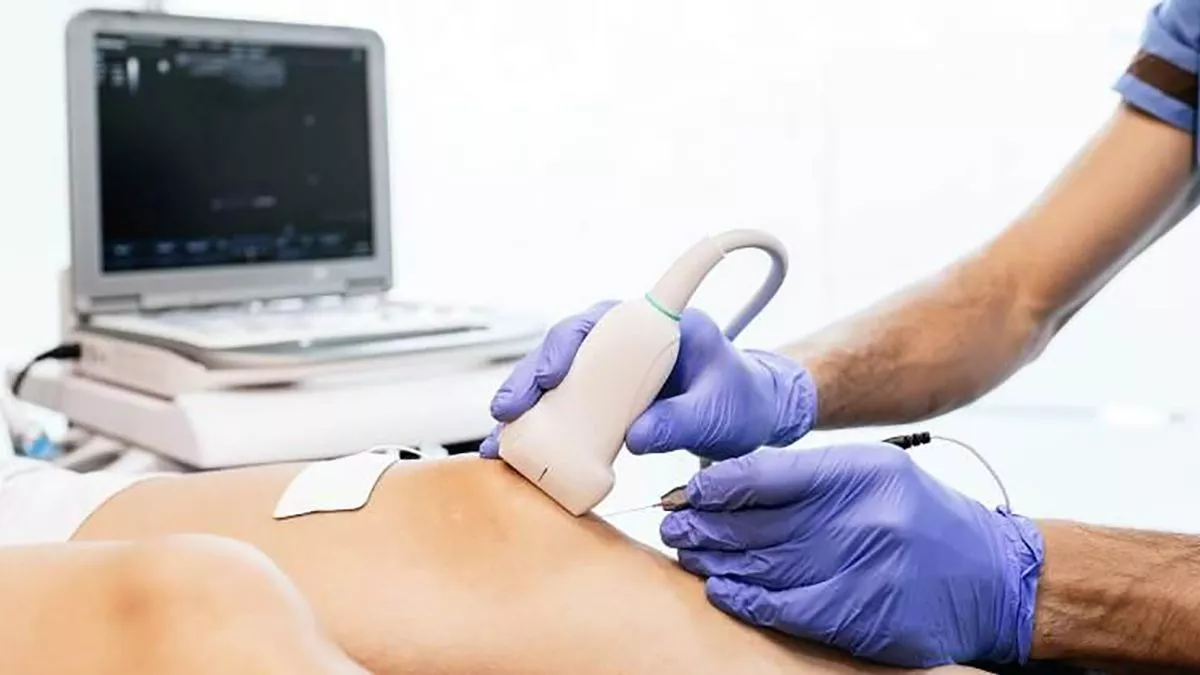 Terapia de Ondas de Choque en Lima | Alivia el Dolor y Recupera tu Movilidad