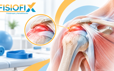 Fisioterapia para bursitis de hombro con ilustración anatómica de la bursa inflamada – FisioFix