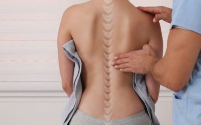 Terapia física para escoliosis