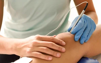 Tratamiento en la microelectrolisis percutánea