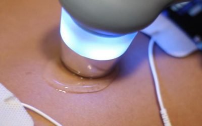 Ultrasonido terapéutico